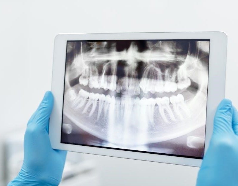 dental fee guide bc 2023